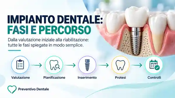 Impianto dentale: quali sono le fasi del percorso